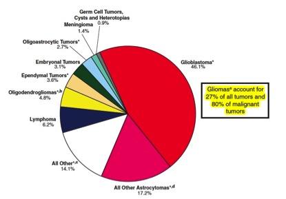 关于脑肿瘤的10个真实的事实
