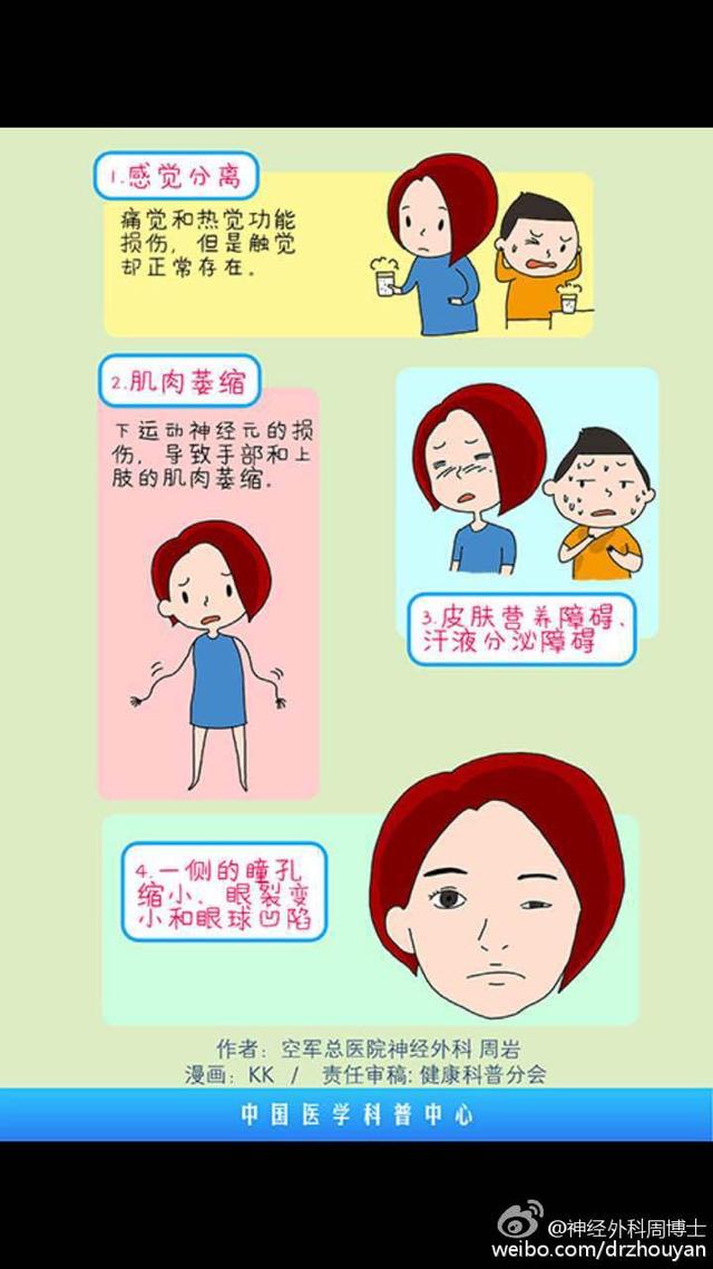 漫画科普 “麻小”的罪证 脊髓空洞症