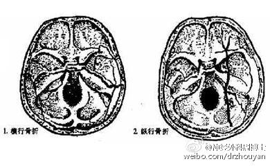 我为什么会“晕”？ “了解眩晕”是正确认识“眩晕”的重要开始