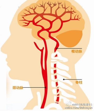 我为什么会“晕”？ “了解眩晕”是正确认识“眩晕”的重要开始