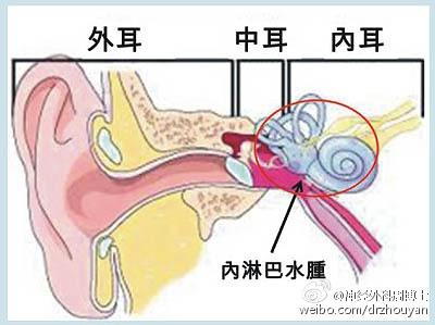 我为什么会“晕”？ “了解眩晕”是正确认识“眩晕”的重要开始