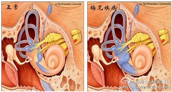 我为什么会“晕”？ “了解眩晕”是正确认识“眩晕”的重要开始