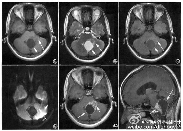 我为什么会“晕”？ “了解眩晕”是正确认识“眩晕”的重要开始