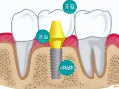 长春欣雅口腔：技术高超，价格实惠，用户评价超赞！