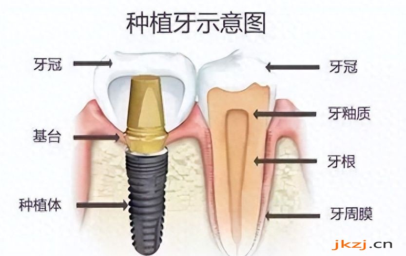 成都牙齿矫正医院排名靠前，效果好的有哪些？