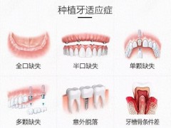 太原哪家医院治疗全瓷牙效果好？口碑口碑好的几家推荐！