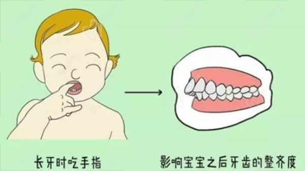 mrc早期干预矫正适应症