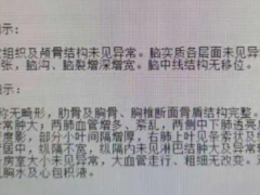 心力衰竭发作，少不了的扩血管、平喘、利尿治疗