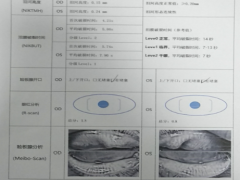 双眼干涩、异物感需重视，当心是干眼症惹的祸