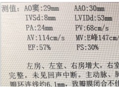 高龄心力衰竭患者，切不可马虎大意！