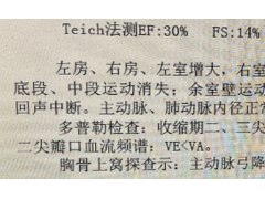 慢性心力衰竭合并肺栓塞，看64岁的她如何治疗