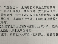 74岁老人突发肺动脉高压，原来与心脏瓣膜有关