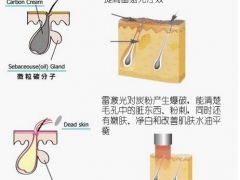 黑脸娃娃除表皮的污垢和角质优缺点