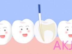 牙齿做根管治疗是不是就废了——根管治疗的作用、效果及副作用