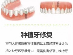 种牙可怕吗？