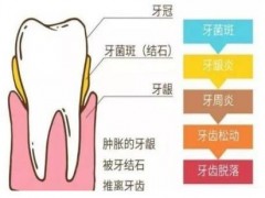 还不看牙洗牙?自己测测牙齿是否真的健康吧?