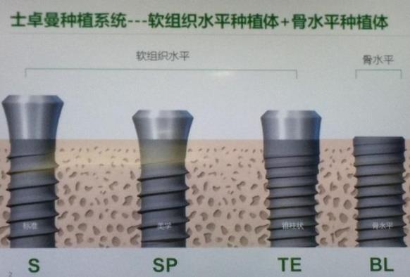 瑞士Straumann种植体