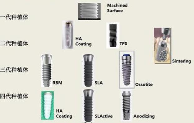 种植体表面处理技术