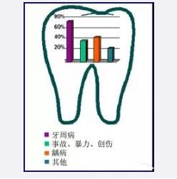 种植牙图片