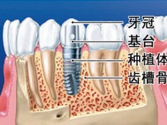 种牙手术后可以喝水吗