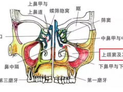 牙齿种植怎么做上颌窦提升术