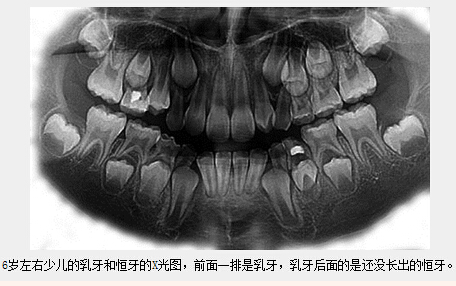 乳牙列和恒牙列拍片