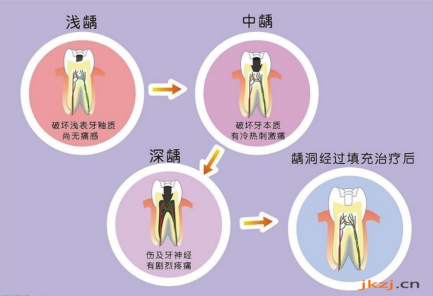 不同蛀牙