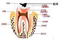 深圳小孩牙齿矫正多少钱