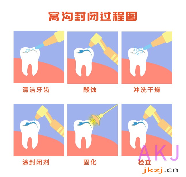 沟窝封闭过程