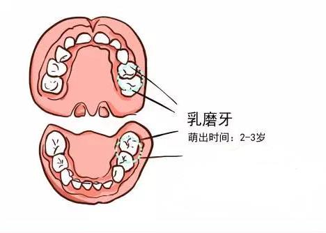 窝沟封闭几岁做