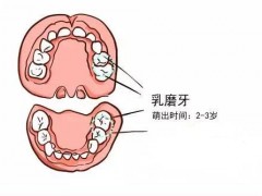 窝沟封闭几岁做