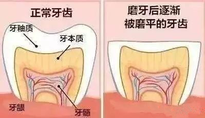 磨牙的危害