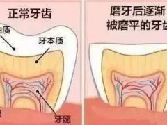 错牙齿是什么问题