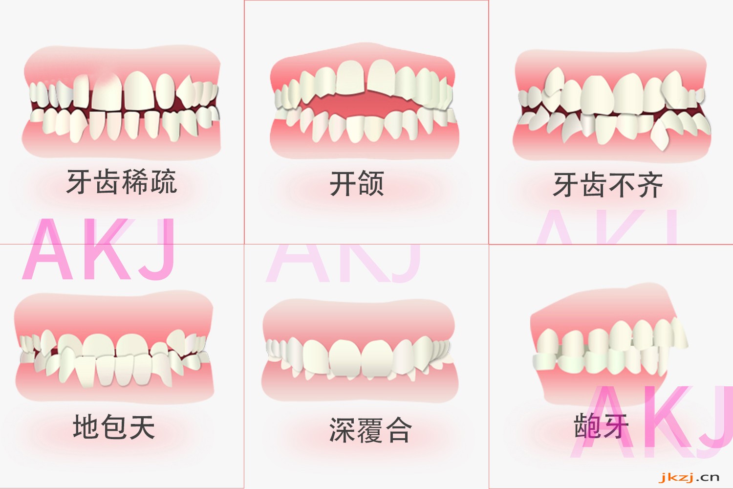 牙齿咬合关系示意图片