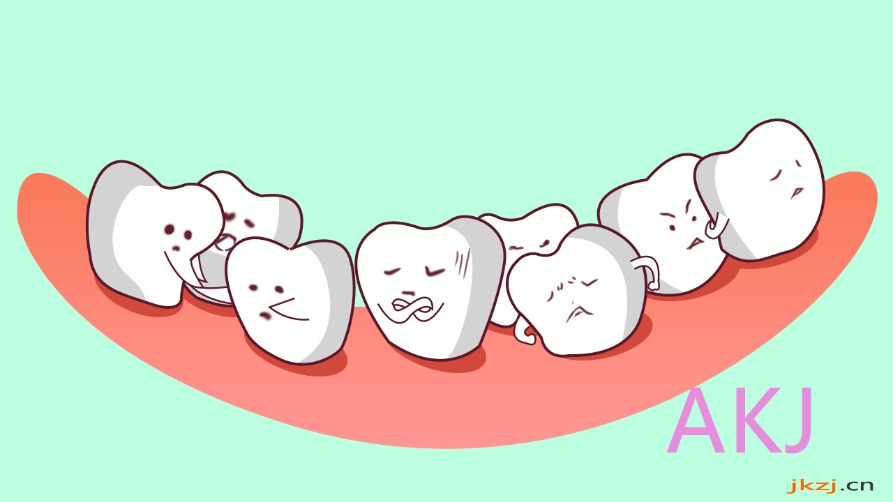 牙齿拥挤