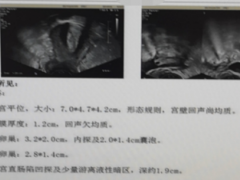 备孕1年仍未怀孕？警惕出现输卵管堵塞！