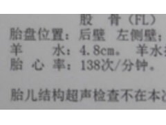 脐带绕颈怎么办？遇到这种情况可考虑剖宫产