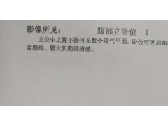 62岁老年男性不知怎么腹痛厉害，原来是肠梗阻作祟