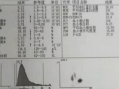 孩子头痛发热呕吐，小心是病毒性脑炎