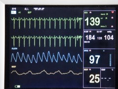 心律失常的护理原则介绍  心律失常如何调节